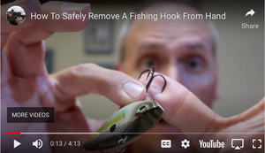 How To Safely Remove A Hook-View Video
